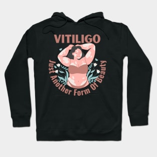 Vitiligo Just Another Form Of Beauty Female Model Hoodie